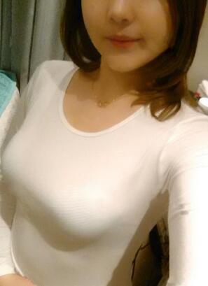 成都艾米麗自體脂肪隆胸三個月啦~