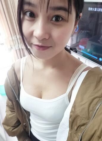 成都艾米麗自體脂肪豐胸前后對(duì)比
