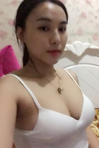 艾米麗自體脂肪隆胸恢復(fù)經(jīng)歷