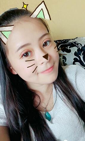 梨花雨割雙眼皮恢復(fù)半年了