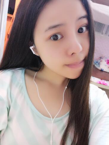 隆鼻整形真實(shí)恢復(fù)期圖片 隆鼻整形一個月了