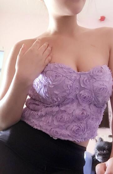 自體脂肪豐胸對比圖 抽脂隆胸十天