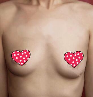 抽脂隆胸一個月 果自然