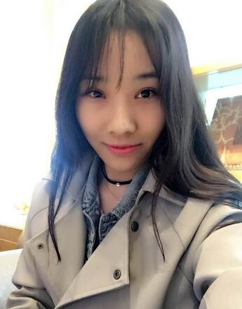 開眼角加雙眼皮15天恢復(fù)圖