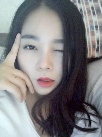 隆鼻整形日記 重慶鉑生硅膠隆鼻+耳軟骨鼻尖