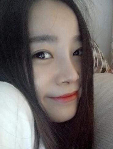 隆鼻整形日記 重慶鉑生硅膠隆鼻+耳軟骨鼻尖