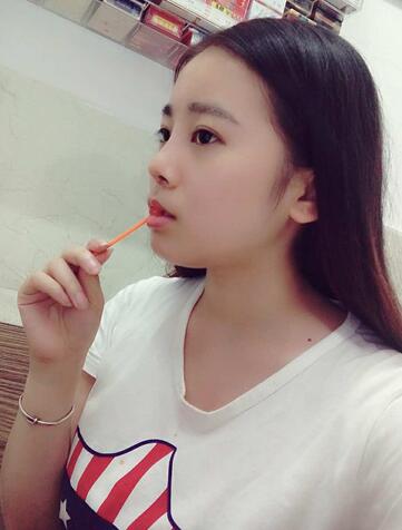 隆鼻整形日記 重慶鉑生硅膠隆鼻+耳軟骨鼻尖