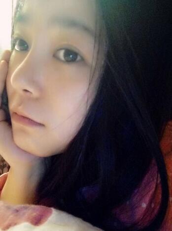 隆鼻整形日記 重慶鉑生硅膠隆鼻+耳軟骨鼻尖