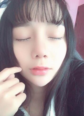 隆鼻修復(fù)術(shù)后恢復(fù)期經(jīng)歷