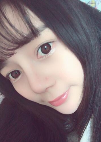 隆鼻修復(fù)術(shù)后恢復(fù)期經(jīng)歷