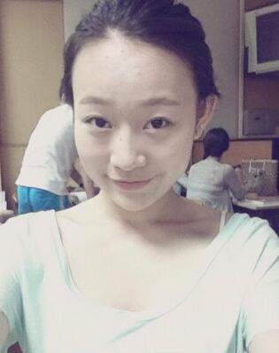 種植眉毛后二年圖片