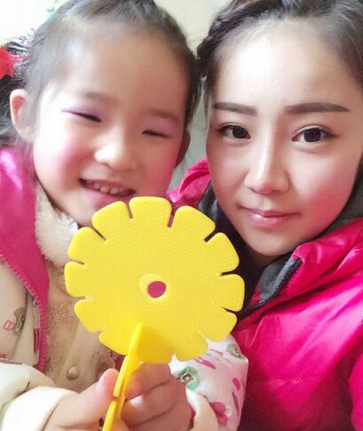 耳軟骨墊鼻尖三個月圖 耳軟骨墊鼻尖+硅膠隆鼻