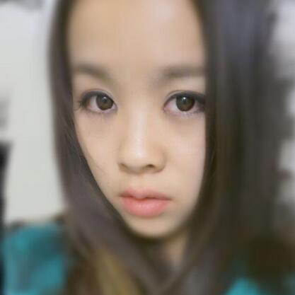 耳軟骨墊鼻尖+隆鼻+鼻翼縮小3個月了