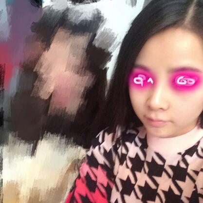 耳軟骨墊鼻尖+隆鼻+鼻翼縮小3個月了