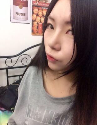 隆鼻整形真實(shí)恢復(fù)期圖片 硅膠隆鼻+鼻頭縮小