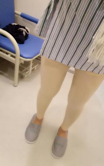 武漢詮美大腿吸脂后恢復過程