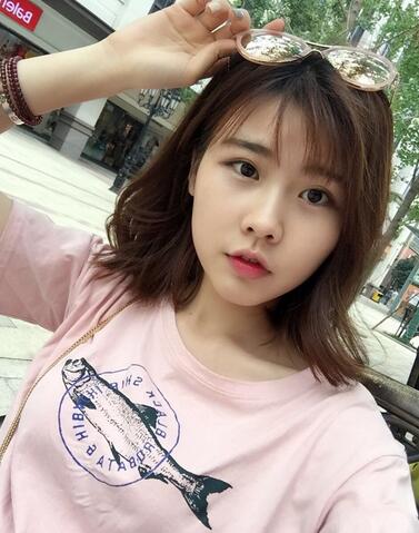 武漢西嬋康美玻尿酸隆鼻恢復過程圖