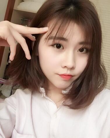 武漢西嬋康美玻尿酸隆鼻恢復過程圖