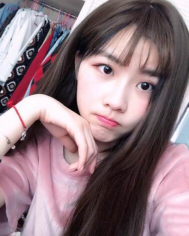 武漢西嬋康美玻尿酸隆鼻恢復過程圖