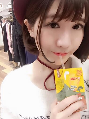 杭州王圣林全切雙眼皮恢復(fù)過程圖