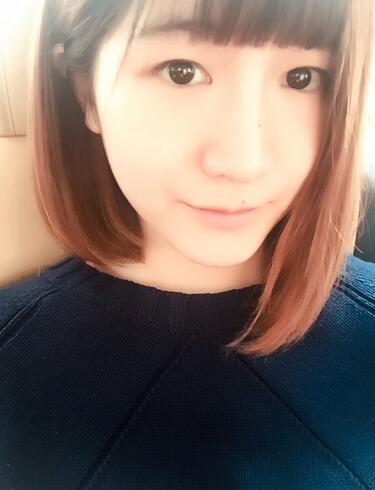 杭州王圣林全切雙眼皮恢復(fù)過程圖