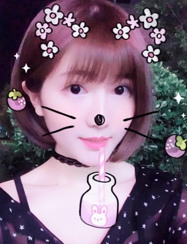 杭州王圣林全切雙眼皮恢復(fù)過程圖