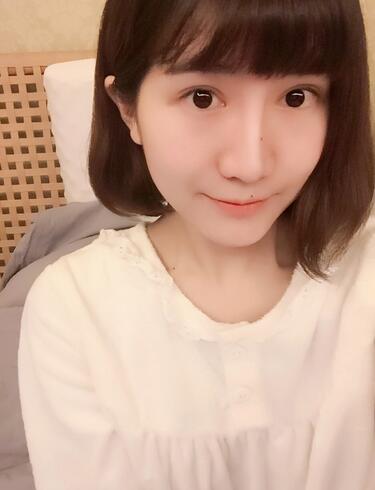 杭州王圣林全切雙眼皮恢復(fù)過程圖