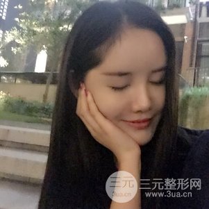 南京米尚恩陳天杰自體脂肪填充全臉 女神的養(yǎng)成記!