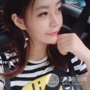 南京克拉美鼻部韓式生科芭比線條修復(fù)