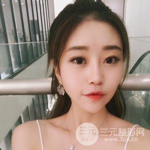 南京克拉美鼻部韓式生科芭比線條修復(fù)