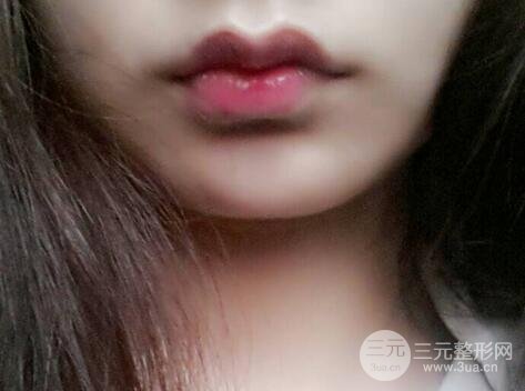 zuichunzhengxingxuyaoduoshaoqian6