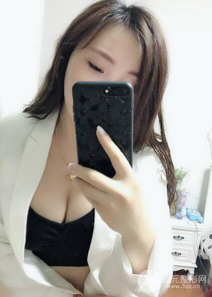 自體脂肪豐胸3個月分享，活細胞豐胸術后果逼真更自然