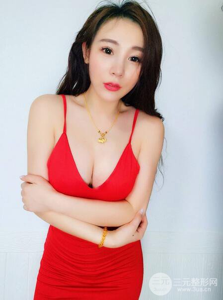 自體脂肪豐胸3個月分享，活細胞豐胸術后果逼真更自然