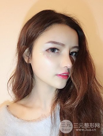 全臉自體脂肪填充+隆鼻整形果永.久保持、丑小鴨變天鵝不是夢(mèng)