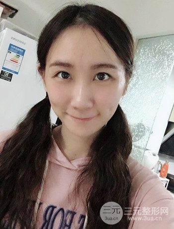 面部埋埋蛋白線.提升改良皮膚松弛，立現(xiàn)小V臉