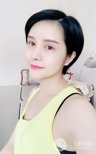 做了隆鼻整形隆鼻之后，短發(fā)女孩也可以性感！