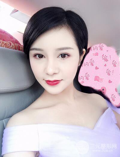 做了隆鼻整形隆鼻之后，短發(fā)女孩也可以性感！