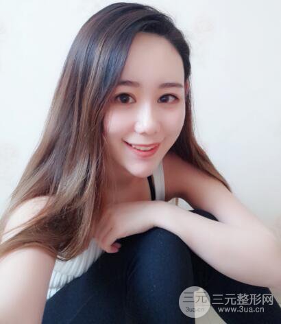 全臉自體脂肪填充，填充不飽滿還可以瘦臉_真人案例