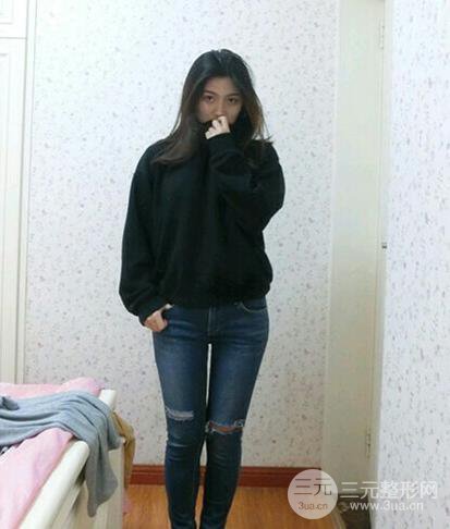 大腿吸脂后恢復(fù)過程及術(shù)后照片分享【圖片】