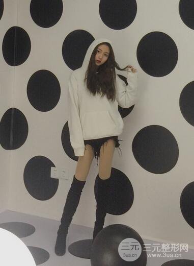 大腿吸脂后恢復(fù)過程及術(shù)后照片分享【圖片】