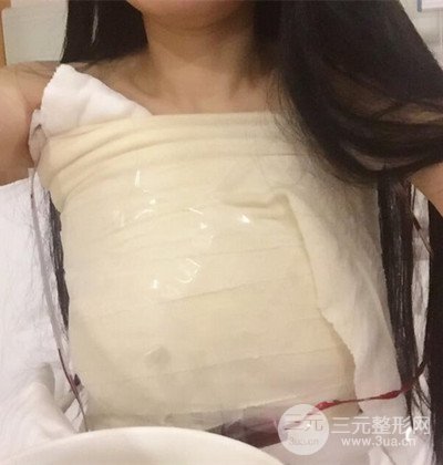 假體隆胸手術(shù)恢復(fù)記錄，豐滿大胸不是夢(mèng)