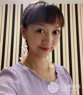 北京雙眼皮失敗修復(fù)手術(shù)日記分享，附上前后對(duì)比照片