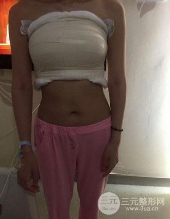 上海假體隆胸真人日記手術(shù)果分享,從A到D不是夢