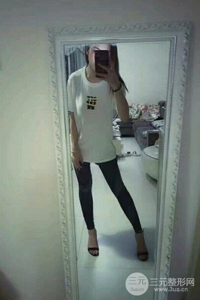 梨型身材做了大腿吸脂之后果超明X，吸脂恢復(fù)過程分享