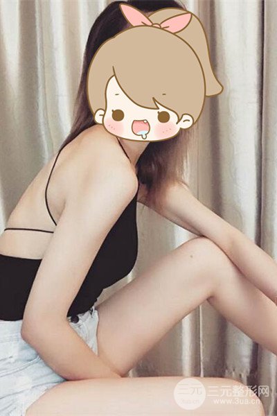 梨型身材做了大腿吸脂之后果超明X，吸脂恢復(fù)過程分享