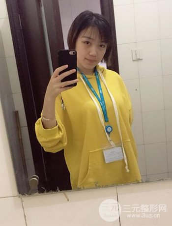 北京內(nèi)切祛眼袋真人案例果對比分享,年輕十歲不是夢