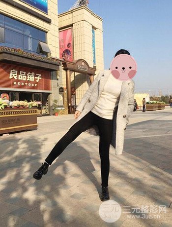 吸脂瘦大腿手術(shù)經(jīng)歷分享,纖細雙腿不再是夢