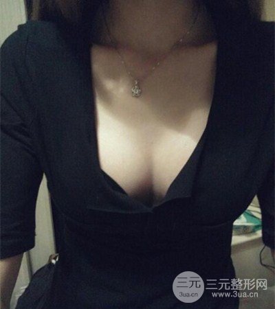 平胸妹做了假體隆胸果分享,豐滿身材不是夢