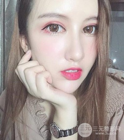 隆鼻整形手術(shù)個(gè)人經(jīng)歷分享,精致小翹鼻不是夢(mèng)