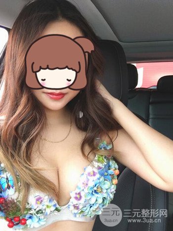 職業(yè)模特做了假體隆胸手術(shù)分享手術(shù)恢復(fù)照片